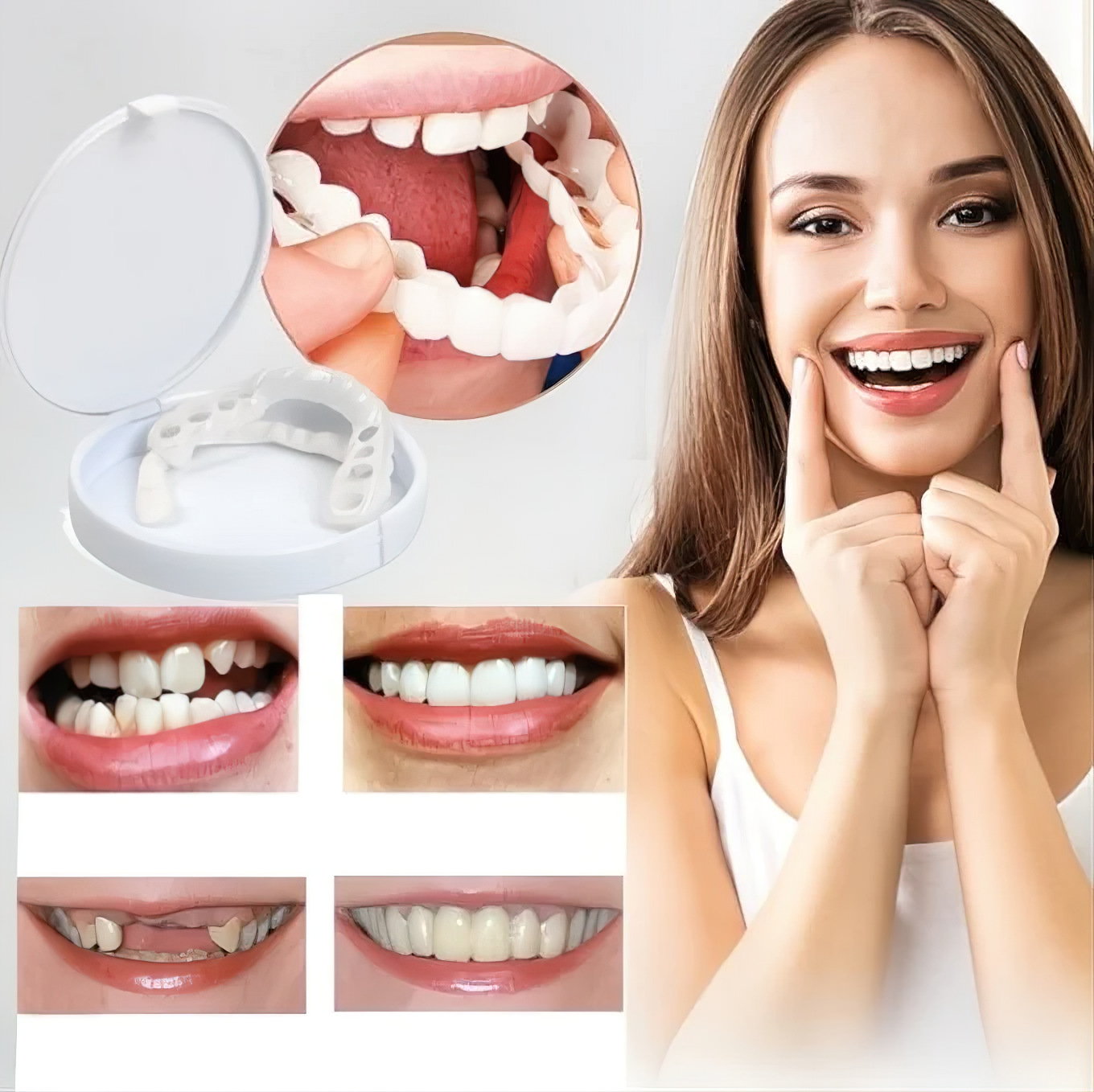Veneers for Teeth with Natural White Finish