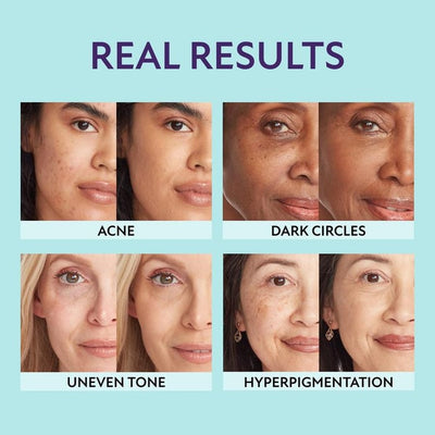 Hydrating Cream Concealer Natural Coverage Makeup